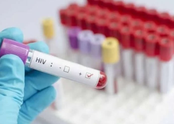 HIV and AIDS population surge in Bono Region – Ghana AIDS Commission