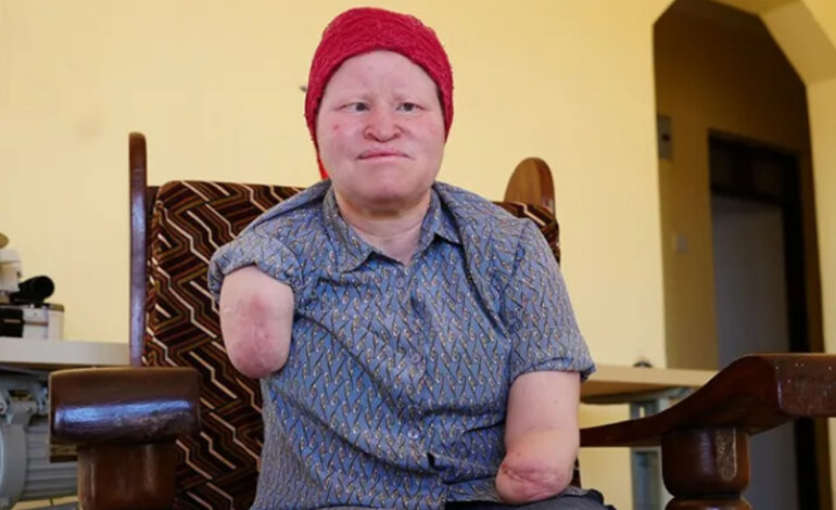 Attacks on people like me happen every time my country has an election