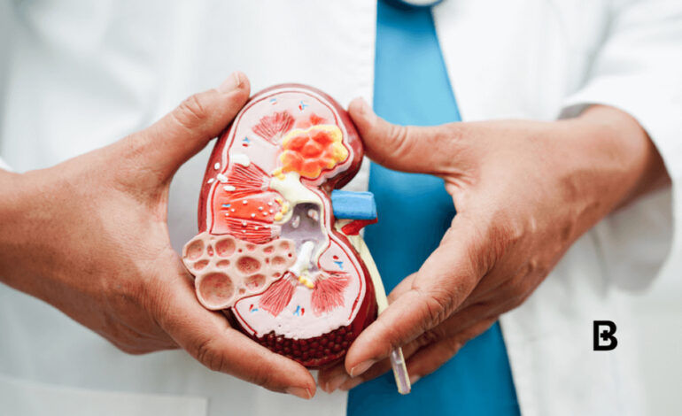 Change your lifestyle to reduce kidney disease – Dr Caesar