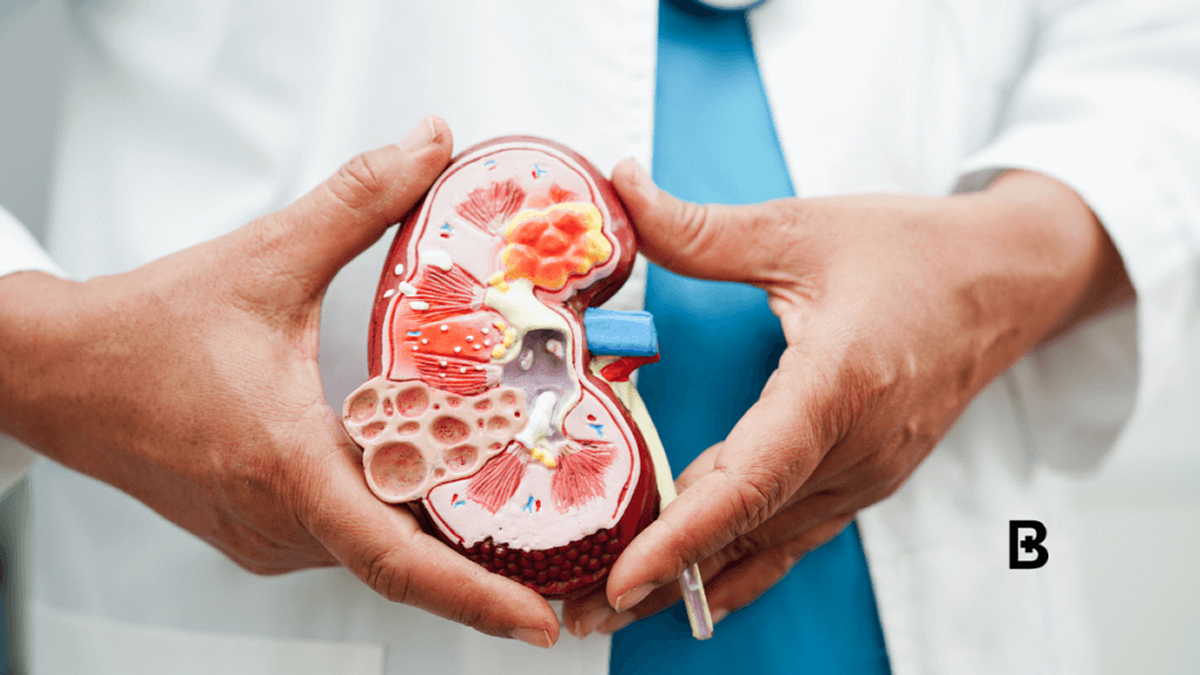 Change your lifestyle to reduce kidney disease – Dr Caesar